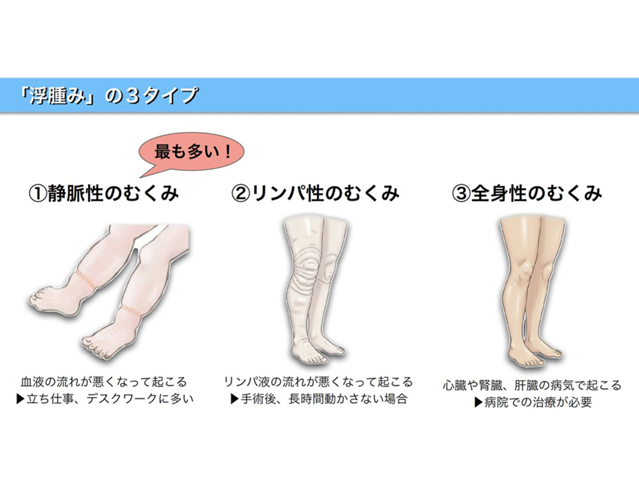 株式会社雄飛堂様にて「むくみ・美容セミナー」をオンラインで開催しました